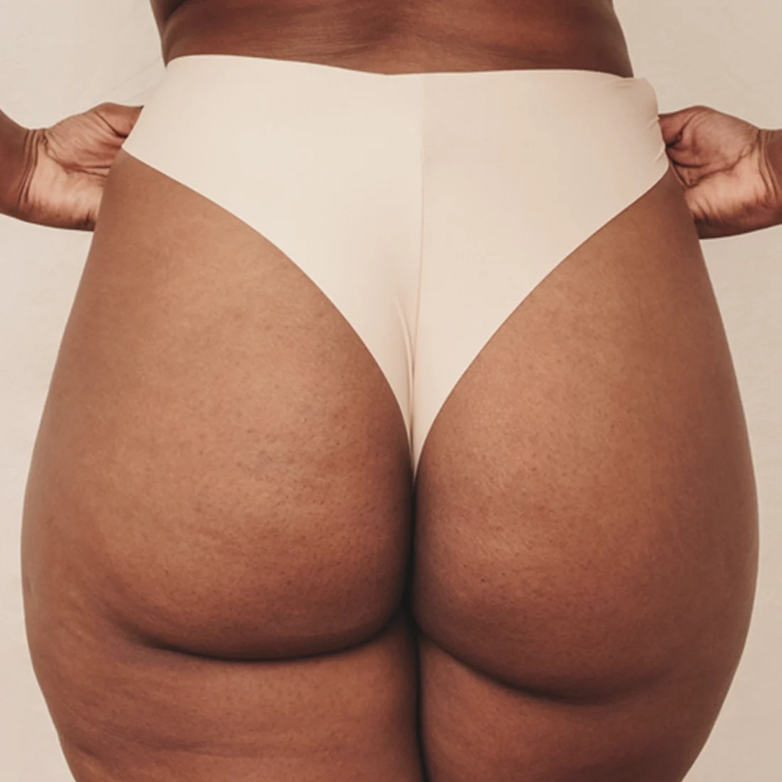 Dr Thomas de Laâge de Meux – Illustration du body lift