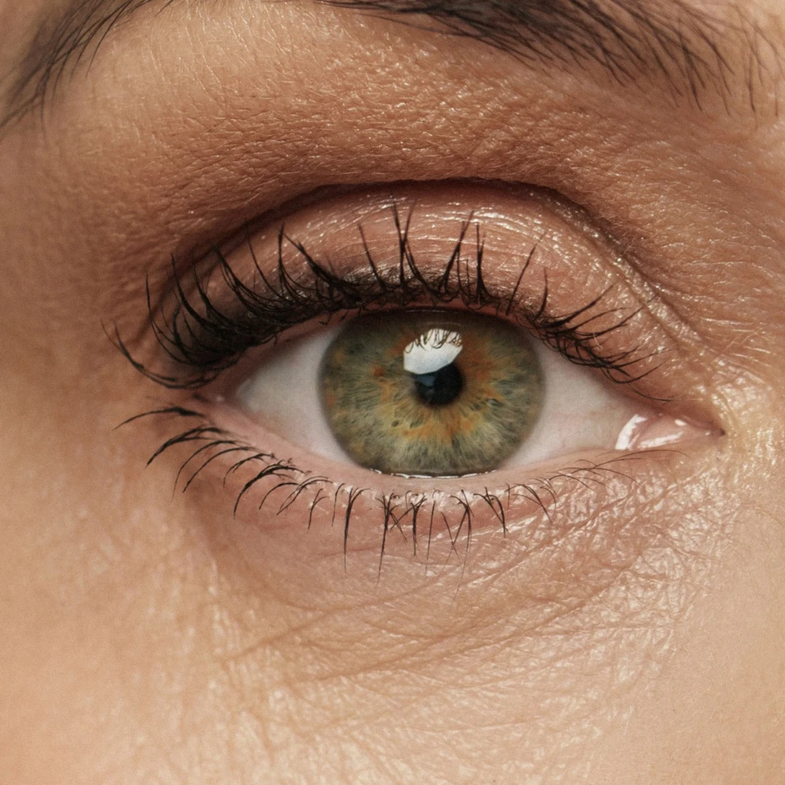 Dr Thomas de Laâge de Meux – Illustration de la blépharoplastie