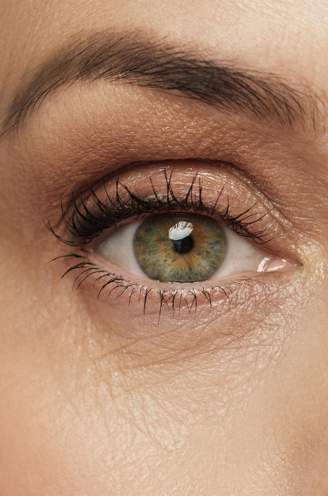 Dr Thomas de Laâge de Meux – Illustration de la blépharoplastie