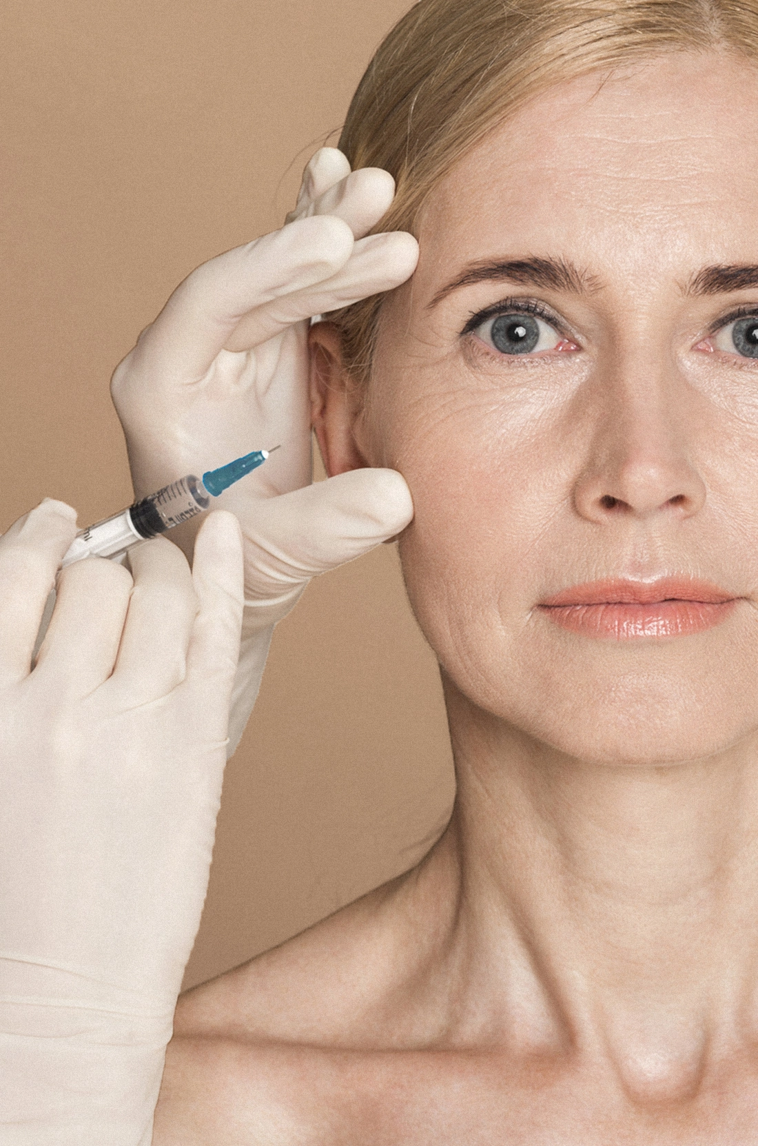 Dr Thomas de Laâge de Meux – Illustration du Botox