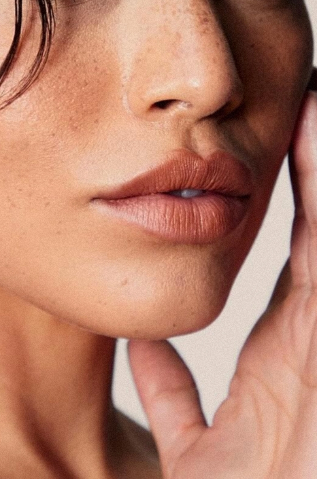 Dr Thomas de Laâge de Meux – Illustration du Liplift