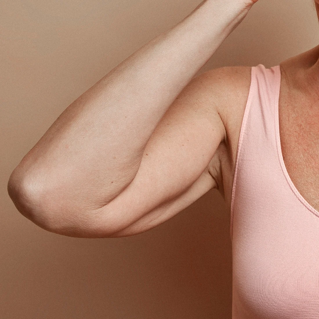 Dr Thomas de Laâge de Meux – Illustration du lifting du bras