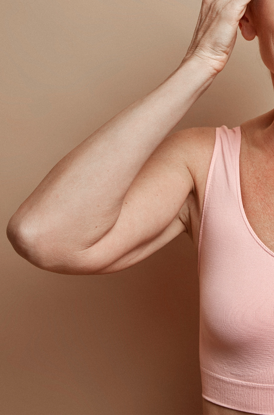 Dr Thomas de Laâge de Meux – Illustration du lifting du bras