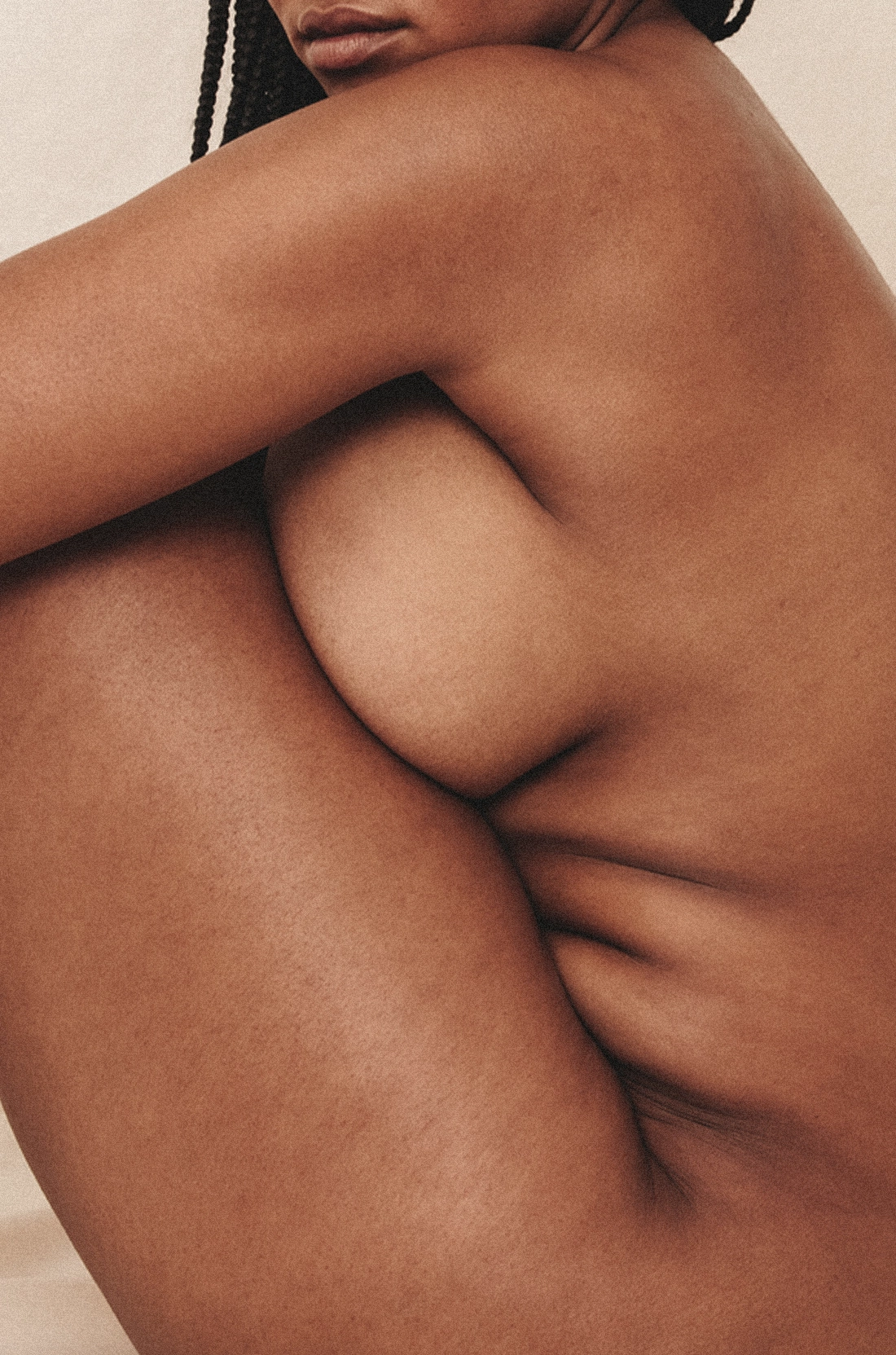 Dr Thomas de Laâge de Meux – Illustration de la réduction mammaire