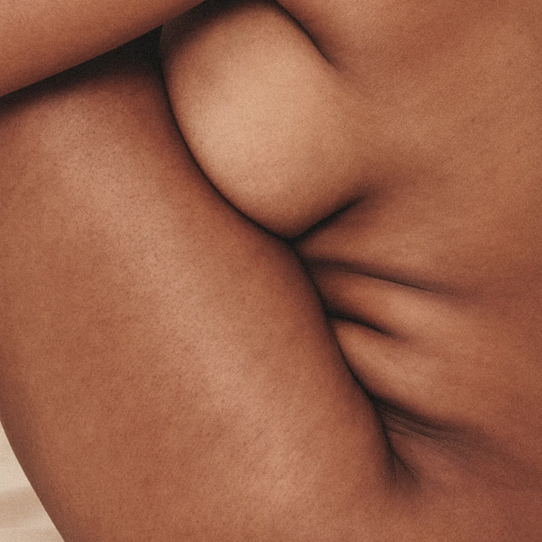 Dr Thomas de Laâge de Meux – Illustration de la réduction mammaire