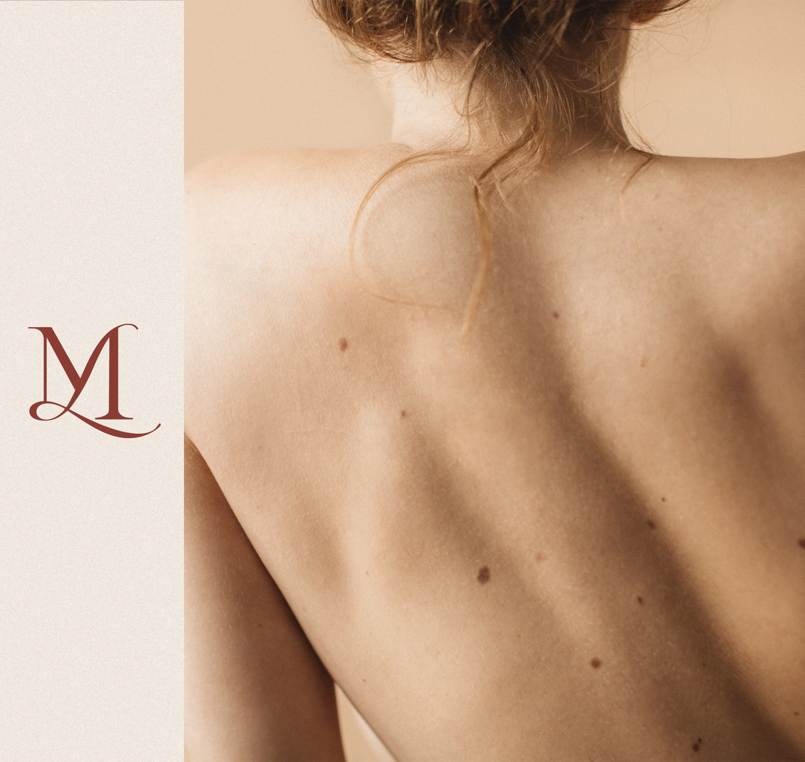 Dr Thomas de Laâge de Meux – Illustration de la chirurgie dermatologique