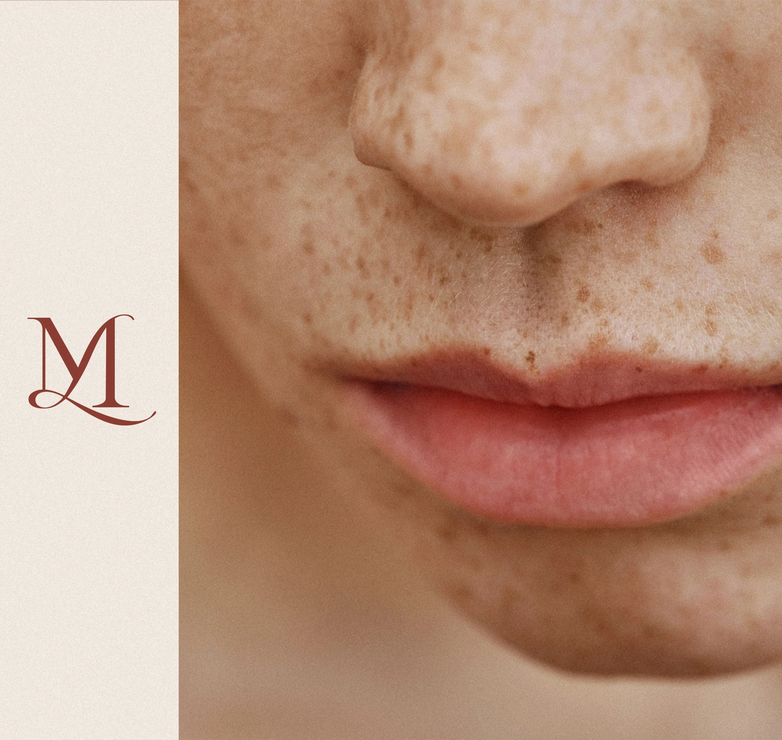 Dr Thomas de Laâge de Meux – Illustration de la chirurgie du visage